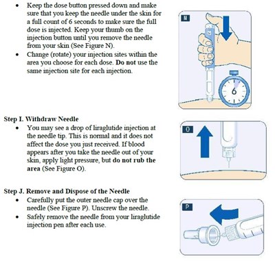 Step I-J.jpg stepi-j - Step I J